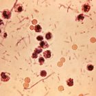 Seven-year-old succumbs to Shigella in Kerala